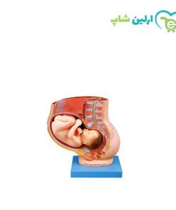 مولاژ مدل حاملگی