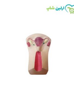 مولاژ ایودی گذاری