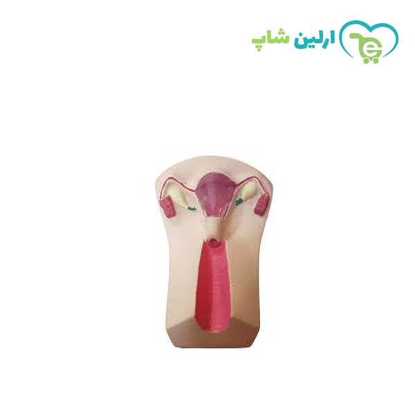 مولاژ ایودی گذاری مولاژ ایودی گذاری