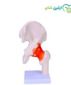 مولاژ ران