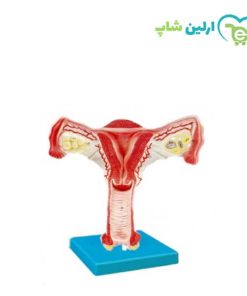 مولاژ رحم سالم