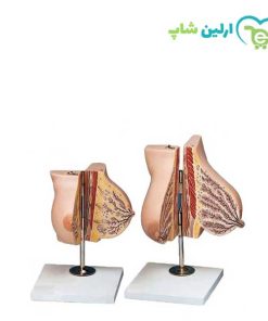 مولاژ سینه قبل و بعد زایمان