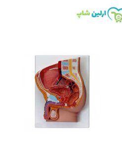 مولاژ مقطع لگن زن