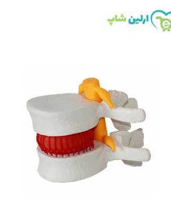 مولاژ مهره دیسک