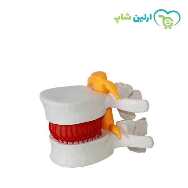 مولاژ مهره دیسک مولاژ مهره دیسک