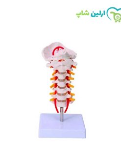 مولاژ مهره‌های گردن
